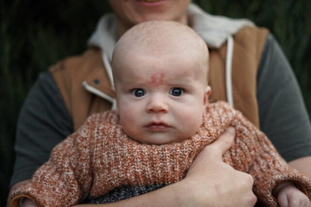 allergie arachide bébé-baby journal