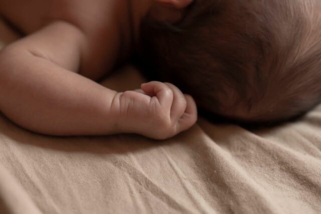 croûtes de lait bébé traitement-baby journal