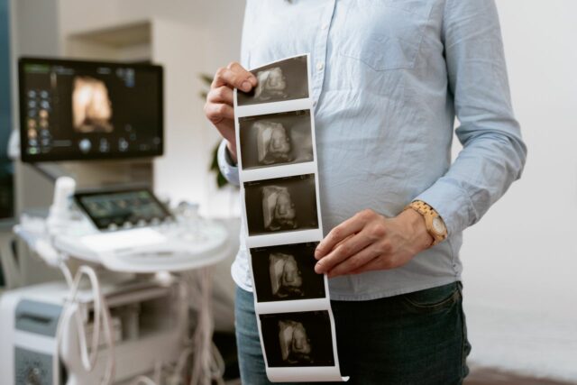 échographie grossesse explications-baby journal