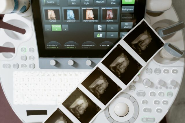 échographie grossesse explications-baby journal