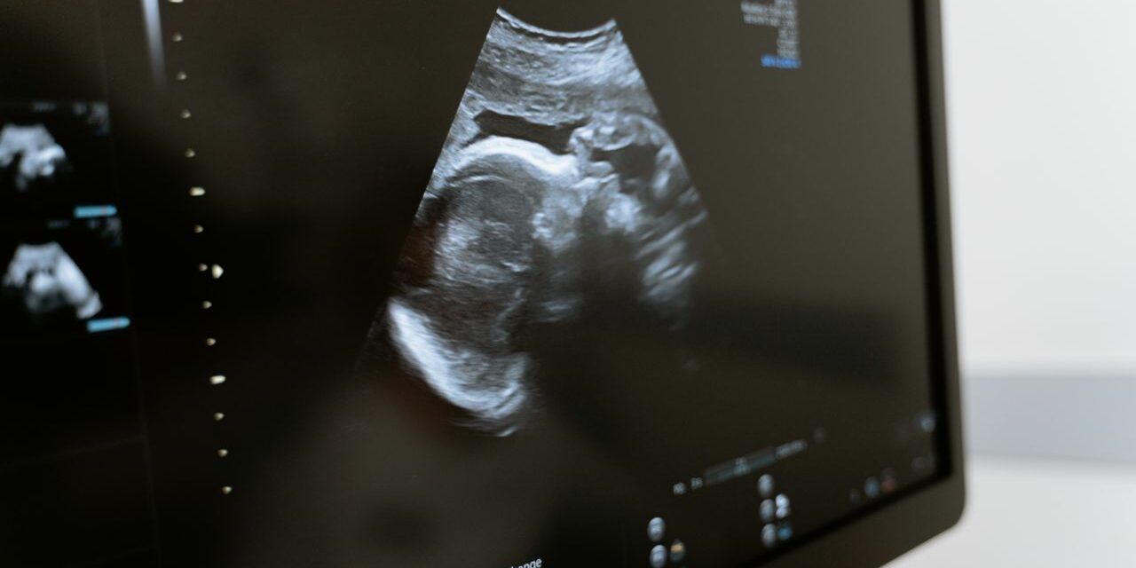 Échographies de Grossesse : À Quoi Sert Chacune et Ce qu&rsquo;on Y Voit