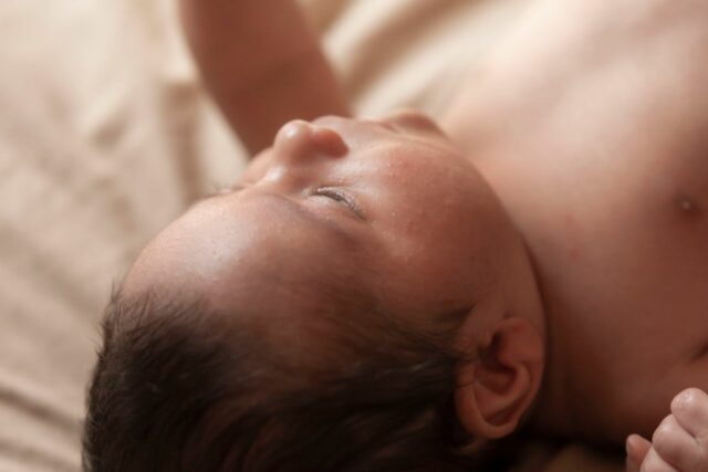 eczéma atopique bébé soigner-baby journal