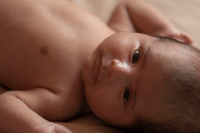 érythème fessier-baby journal