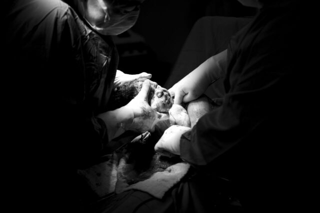 EMDR trauma accouchement difficile-Baby journal