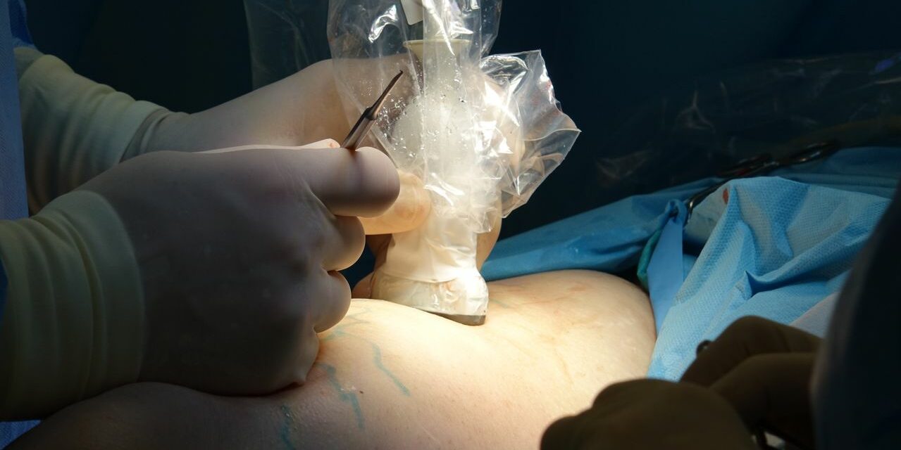 Épisiotomie : Récupération, Soins et Délais Réels de Cicatrisation