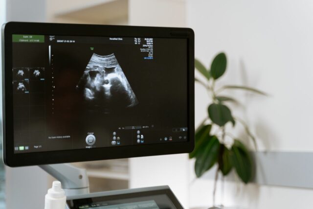 grossesse tardive risques suivi-Baby journal