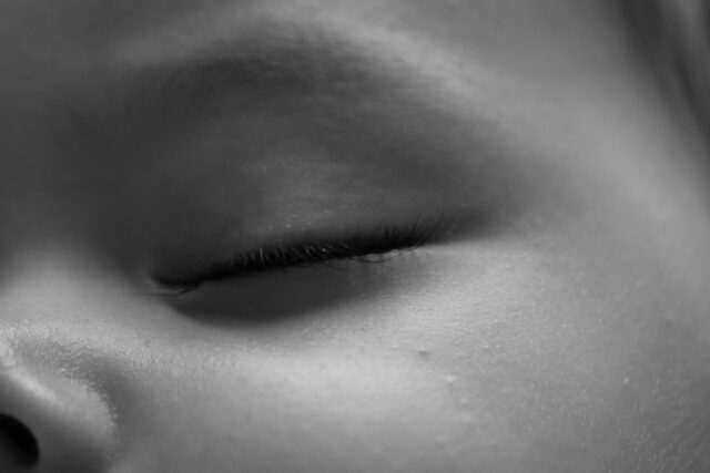 plagiocéphalie bébé casque-Baby journal