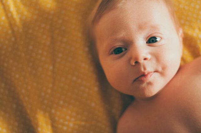 strabisme nourrisson opération-Baby journal